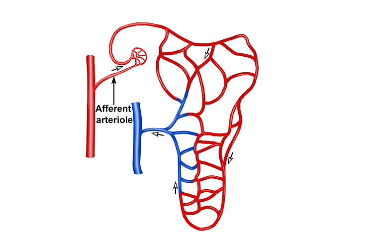 The afferent arteriole is a tiny capillary that carries blood from the renal artery to minuscule blood vessels
